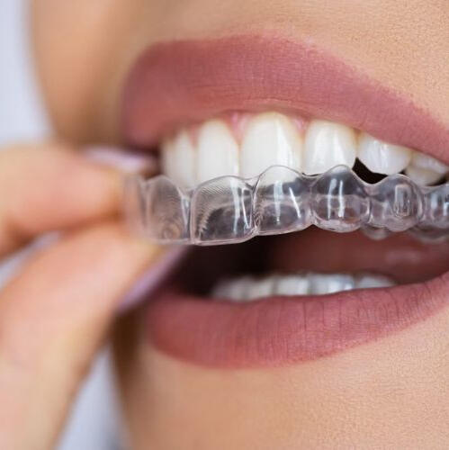 Orthodontic Treatments